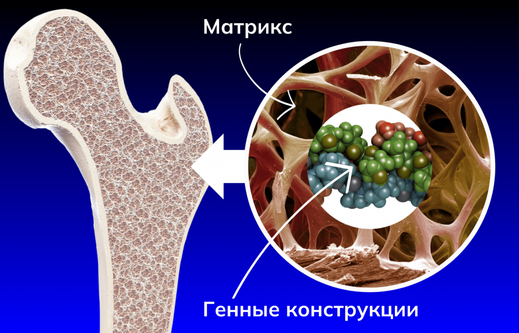 Ученые научатся восстанавливать костную ткань.